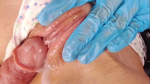 Pervert Doctor Slaps Pussy and Fingers Teen